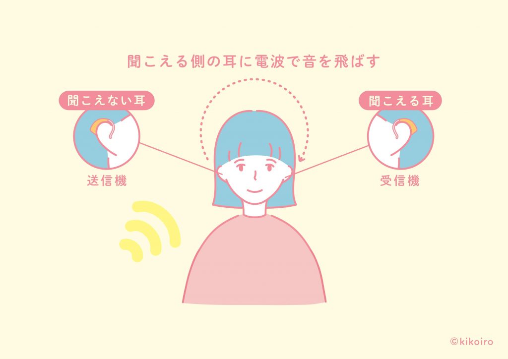 クロス補聴器の仕組みイメージ